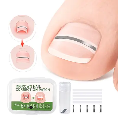 Set flastera za korekciju uraslih noktiju - 10 flastera Srebrna